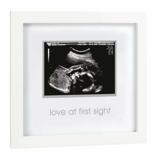 Sonogram Frame